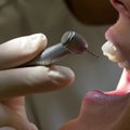HAMBUTU EESTI: Millised erakondade miljoneid neelavad hambaravilubadused on mõistlikud, millised populistlikud?
