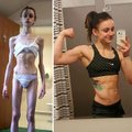 Võimas GALERII: "enne" ja "pärast" fotod naistest ja meestest, kes on saanud võitu anoreksiast