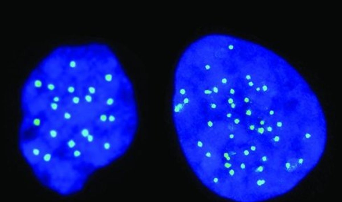 Vasakult: 23 ja 46 kromosoomiga rakk. (Foto: New Yorgi Columbia ülikool / Heebrea ülikool)