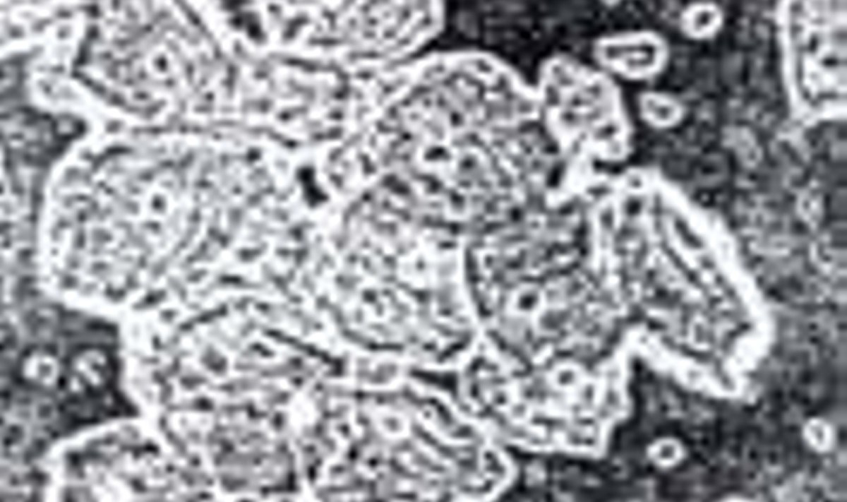 Tupe epteelrakud on tüüpiliselt tihedalt kaetud bakteritega ("clue rakud")