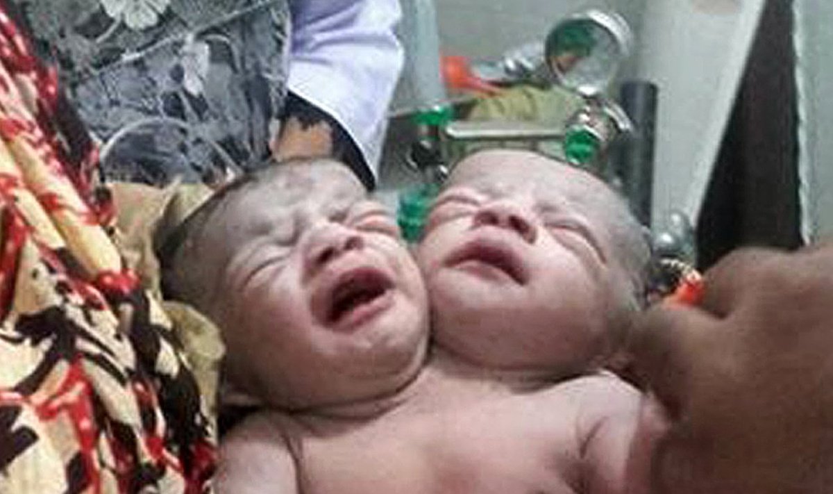 Bangladeshi kahe peaga beebi