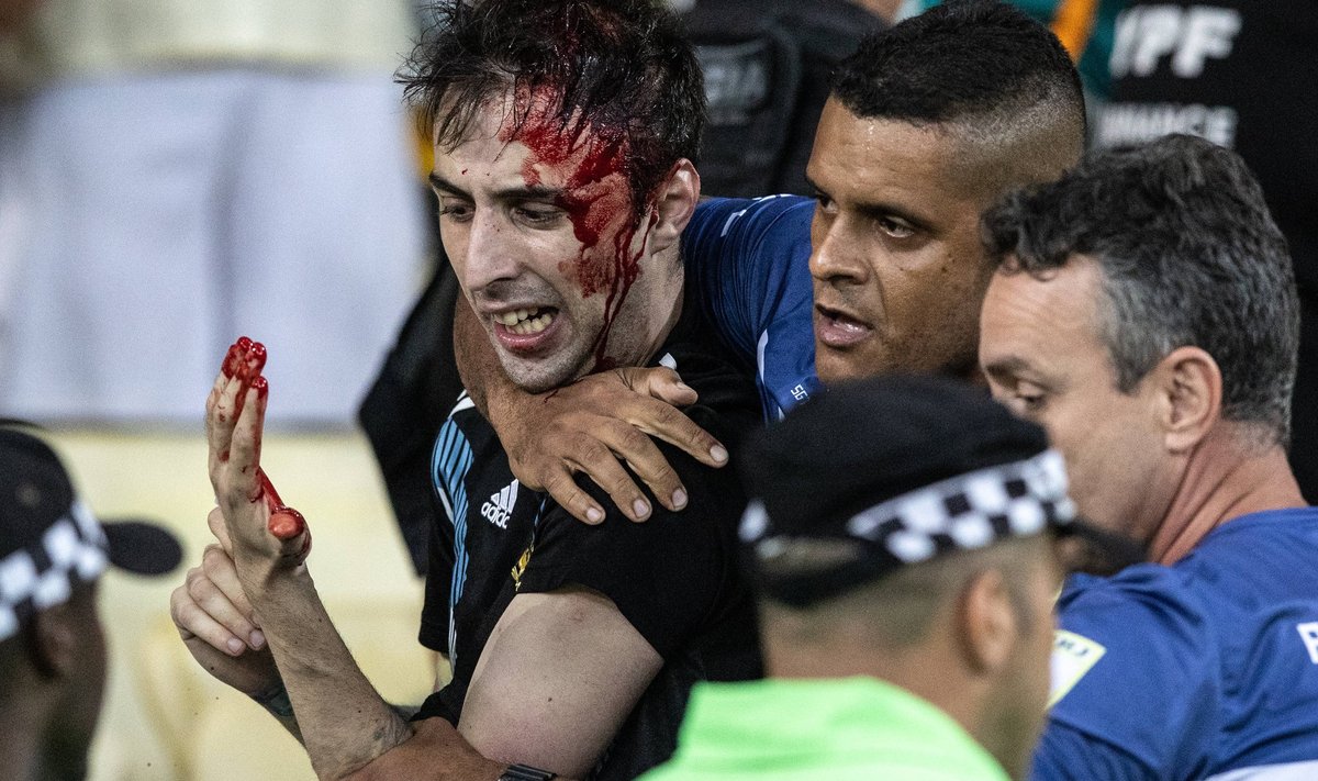 Rahutustes viga saanud Argentina koondise fänn.