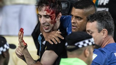 VIDEOD | Brasiilia - Argentina mängul puhkesid rahutused. Messi süüdistas kumminuiaga fänne nüpeldanud politseid julmuses