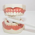 Hambaarst selgitab: miks on suuvee kasutamine ilma arsti ettekirjutuseta ohtlik ja mida me hambaid pestes valesti teeme?