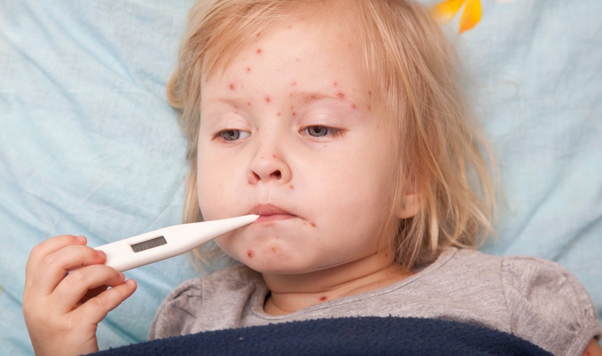 Leetrite viirus on äärmiselt nakkav ja levib õhu kaudu kergesti.