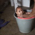 GRAAFIK: Lastel ajukahjustust tekitav Zika viirus levib WHO teatel üle kogu Ameerika
