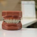 Huvitav teada: kuidas stress su hambad auklikuks kulutab