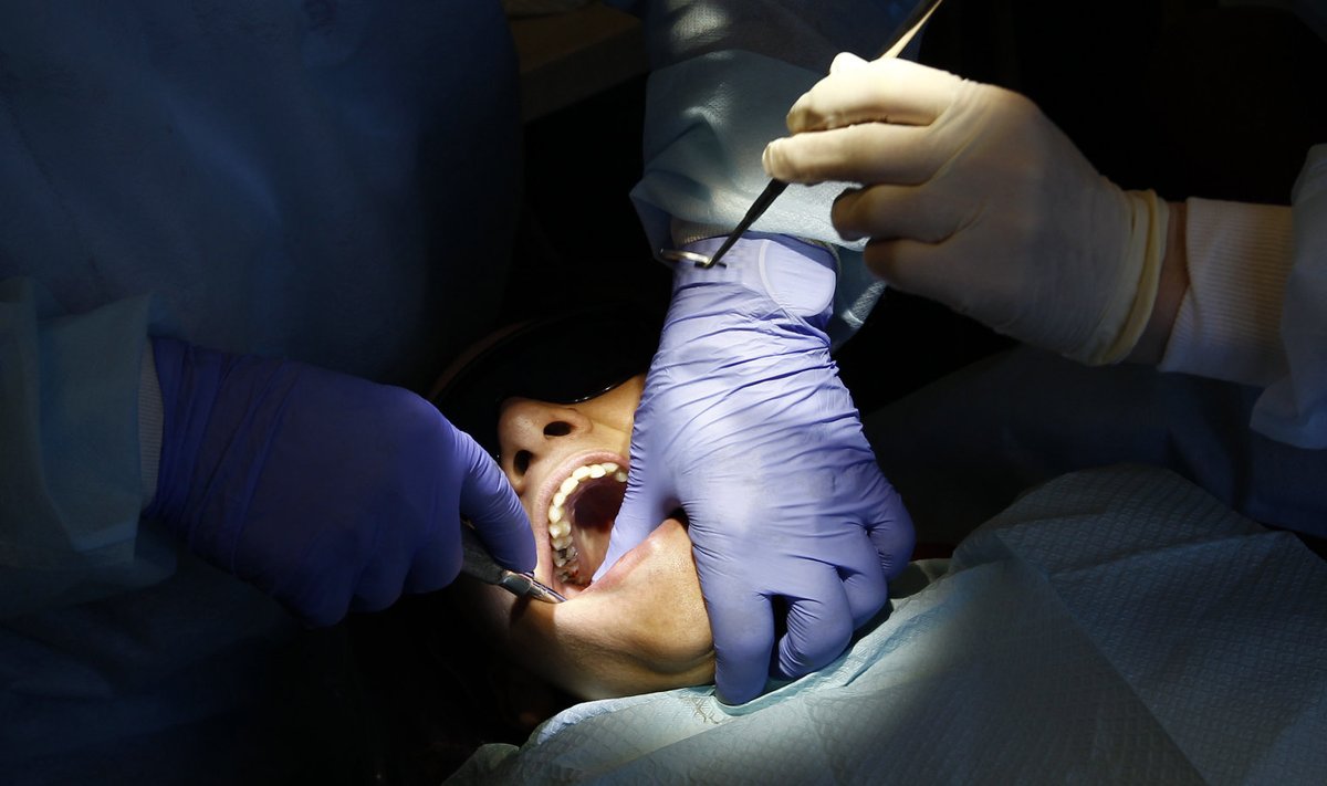 Judinaidtekitav pilt. Kohe tõmmatakse patsiendil hammas välja.