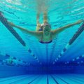 Austraalia ujuja karmi lõpuga ülikoolipidu: "Mind uimastati ning kui üles ärkasin, olin ilma parema jalata"