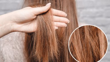 Pikkade talvekuude tulemusena on juuksed täiesti kahjustunud? Nüüd pead just nende vitamiinidega end üllatama