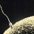 Ülekaalulisus halvendab sperma kvaliteeti