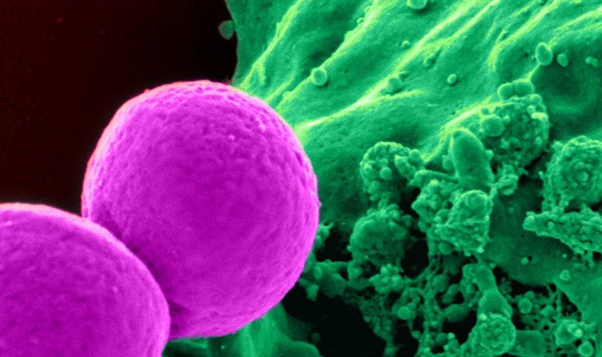 Elektronmikroskoobifoto metitsilliinile resistentsest Staphylococcus aureus'est, mis on tihti haiglates leviv ja sageli surmajuhtumeid põhjustav "superbakter".