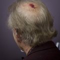FOTOD: Bill Murray ilmus punasele vaibale lõhkise peaga
