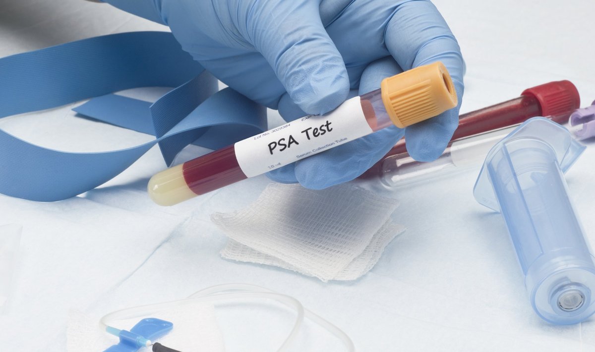 Peamine põhjus, miks eesnäärmevähki üha rohkem diagnoositakse, on prostataspetsiifilise antigeeni (PSA) markeri kasutuselevõtmine.