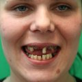 TÄNA! Minu imeline muutumine: 26aastane hambutu ja ülekaaluline Häli ei saa oma välimuse pärast normaalselt elada