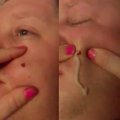 VIDEO | Nõrganärvilistele keelatud! Vaata, kuidas naine pigistab oma abikaasa neli aastat "küpsenud" vistrikku