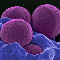 Uus antibiootikum tapab ka suikunud bakterid