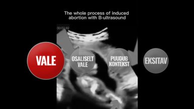 FACT CHECK | Popular video does not show real abortion, but a clip from an anti-abortion film