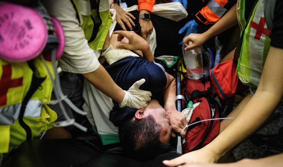 Ööl vastu eilset Hongkongi lennujaamas viga saanud mees, keda meeleavaldajad pidasid Hiina spiooniks. Pildil toimetavad parameedikud teda lennujaamast haiglasse.