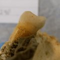 4000 aastat vanade inimjäänuste purihammastest leiti hambakaariest põhjustavaid baktereid