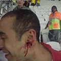 VIDEO: Uskumatult jõhker! Inglise fännil hammustati Uruguayga mängu ajal tükk kõrvast!