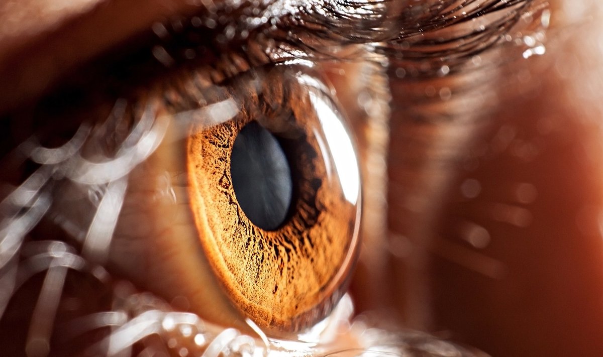 Silmade tervis sõltub organismi üldisest heaolust.