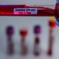 Uut koroonaviirust leevendab HIV ja gripiravimite kokteil