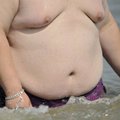 Mis põhjustab äärmuslikku ülekaalulisust?