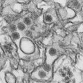 Zika viirus avastati ka USA Virginia osariigi elanikul