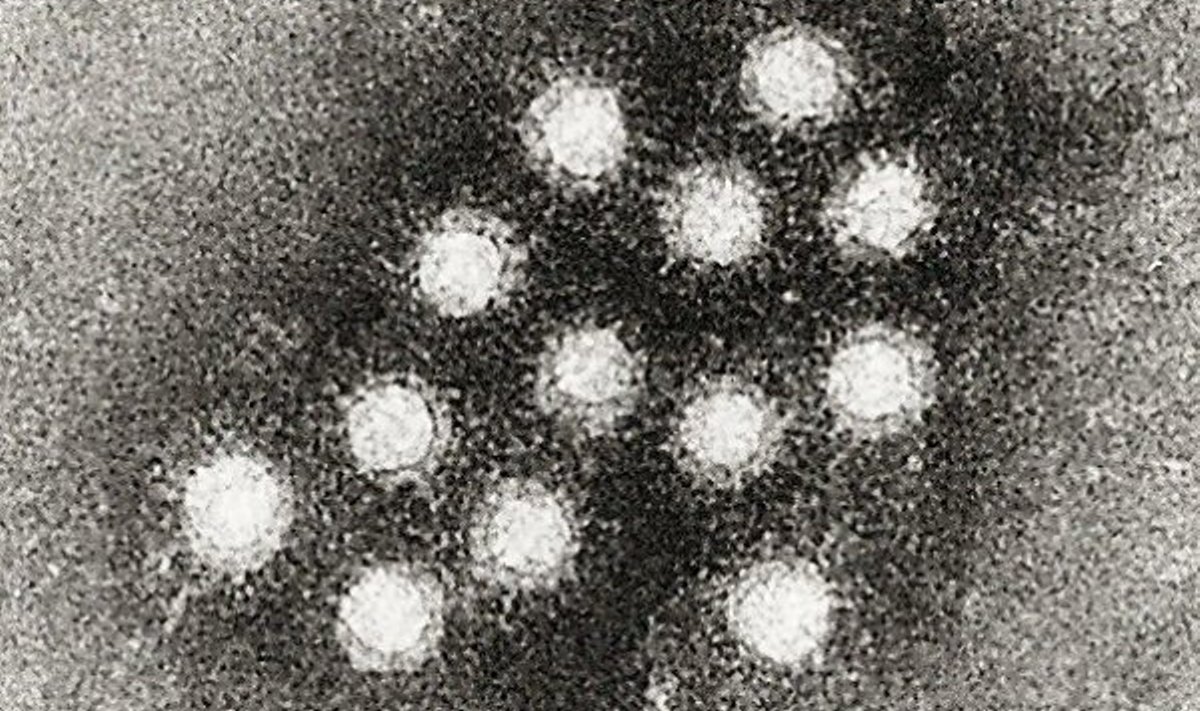 A-hepatiidi viirus
