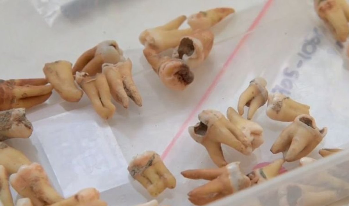 Väljakaevamistel leitud hambad
