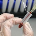 Eestlaste leiutatud HIV-vaktsiini katseid saatis edu