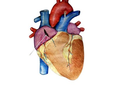 SALAPÄRANE AUK: Auk südamekojalei näidanud end ei ultrahelis egakompuutertomograafis.