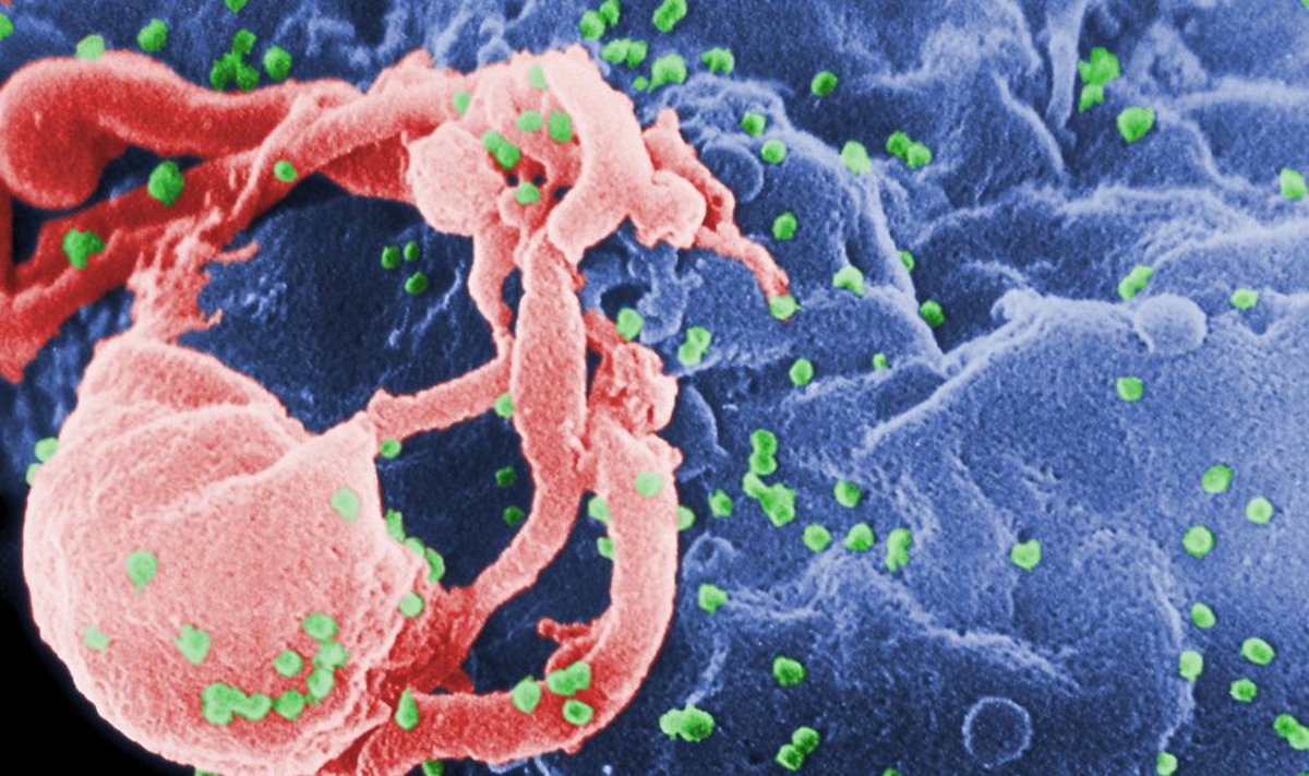   Lümfotsüüdist väljuvad HI-viiruse osakesed (roheliseks värvitud).  Foto: C. Goldsmith