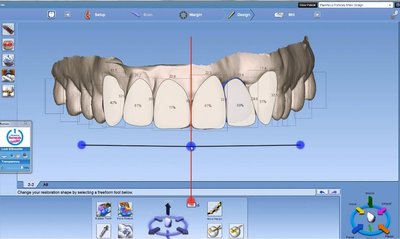 Digitaalne hammaskonna mudel