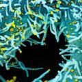 Новый крайне заразный штамм коронавируса распространяется в Эстонии: его доля за неделю выросла на 25%