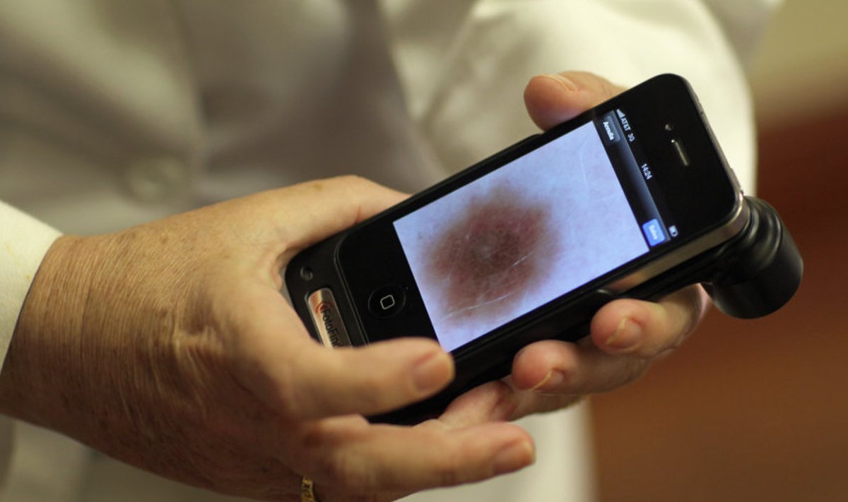 Dermatoloog näitab telefoni salvestatud pilti melanoomist.