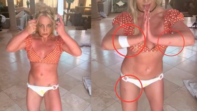 Britney Spearsi haavad