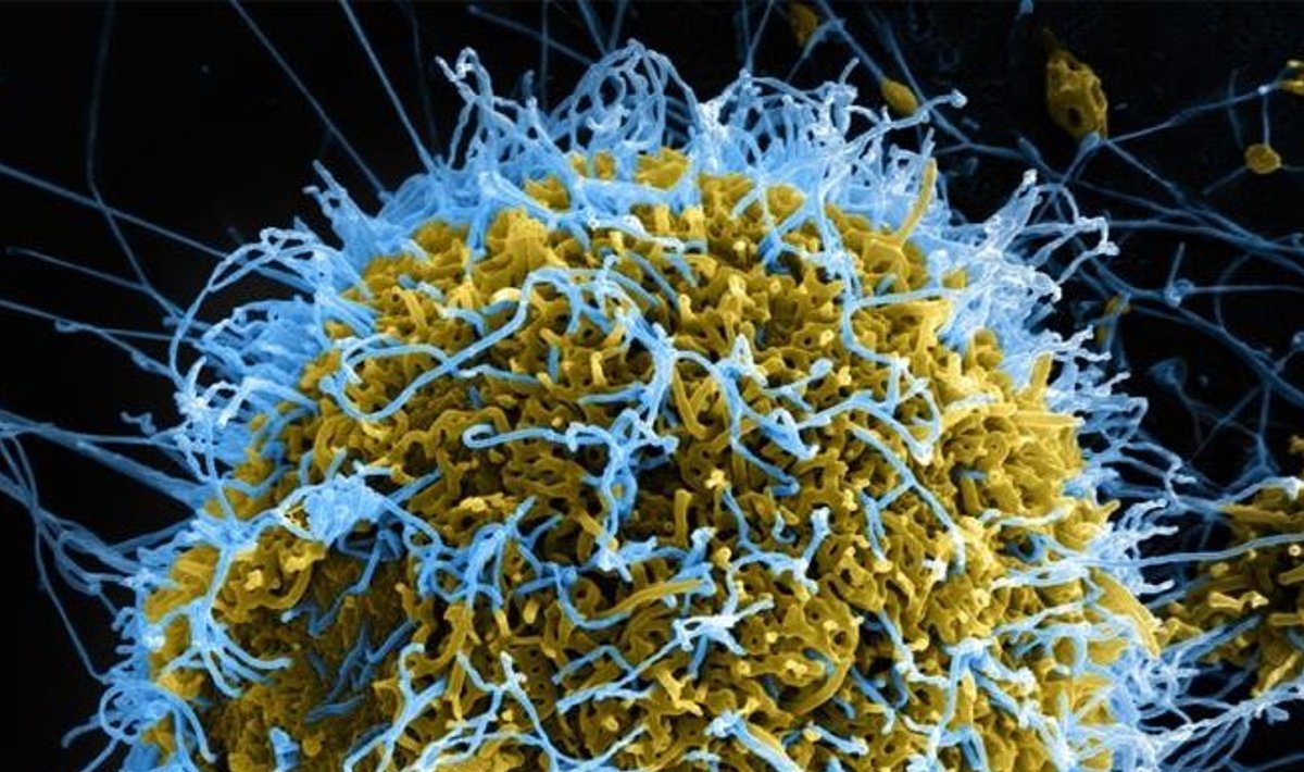 Ebola viiruse osakesed (sinised) tungivad nakatunud rakust välja. Foto: USA riiklik terviseinstituut