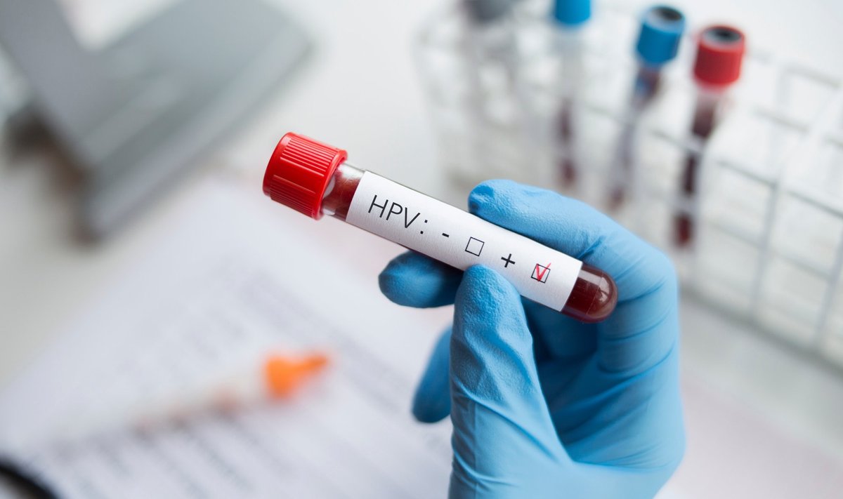 HPV-testil põhineva sõeluuringu korral on võimalik kasutada kodutesti, mis tähendab, et naine saab sõeluuringuks vajaliku proovi võtta ise sobival ajal ning saata see postiga laborisse analüüsimisele.