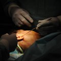 Eesti ilukirurgide kuldkliendid kulutavad lõikuste peale kümneid tuhandeid