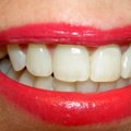 Hambaarst: piima joomine hoiab augud hammastest eemale