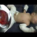 VIDEO | Laps lapses: Indias sündis poiss, kes oli "rase" oma kaksikvennaga