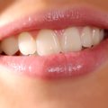 Peagi tuleb valutu hambaravi – hammas kasvab ise terveks