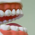 Касается каждого: химики научились выращивать зубную эмаль прямо на зубе