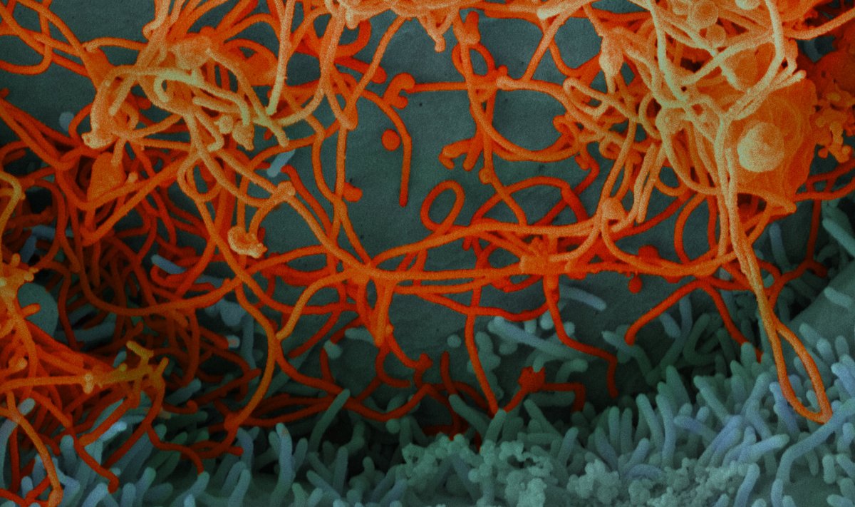 Ebolaviirus Mali patsiendi veres. (Foto: Wikimedia Commons / NIAID)