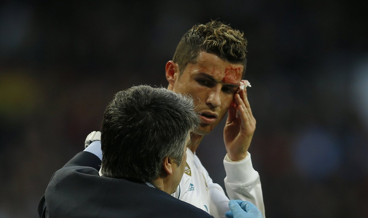 Cristiano Ronaldol löödi kulm lõhki.