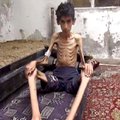 Süüria presidendi toetajad mõnitavad piiratud linnas nälgivaid inimesi hõrgutiste fotodega