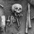 Prantsusmaalt leiti 1500 aastat tagasi maetud Downi sündroomiga laps