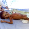 Heategevusorganisatsioon: Jeemenis on näljaohus üle viie miljoni lapse